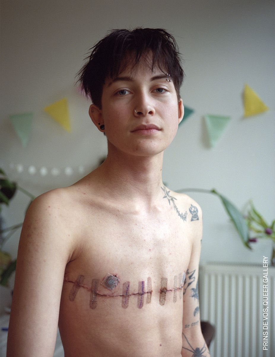 © Prins de Vos/World Press Photo 2025