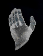 René! I’m Still Standing