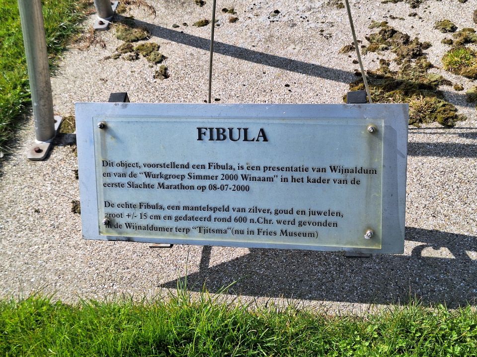 Fibula Wijnaldum